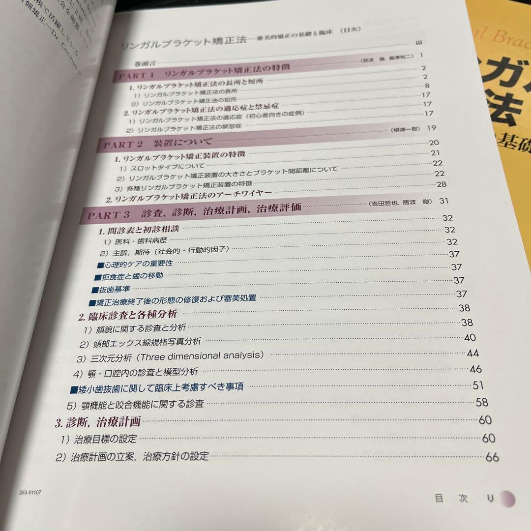 リンガルブラケット矯正法