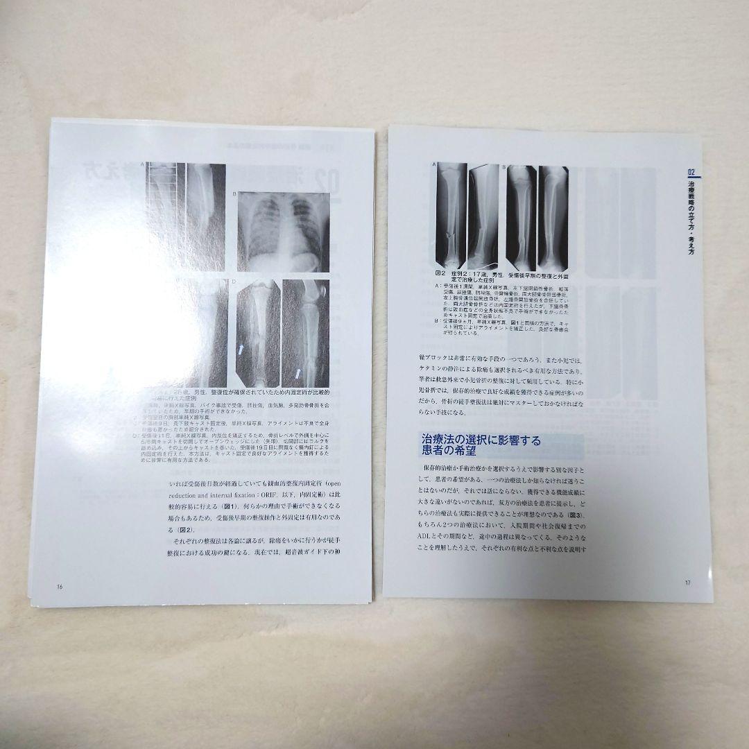 【裁断済】骨折の保存的治療 日常診療の疑問に答える