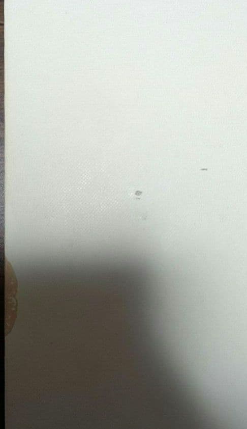 図説整骨学 I 上肢編　山口和司　原勇　接骨　整骨　医学　参考書