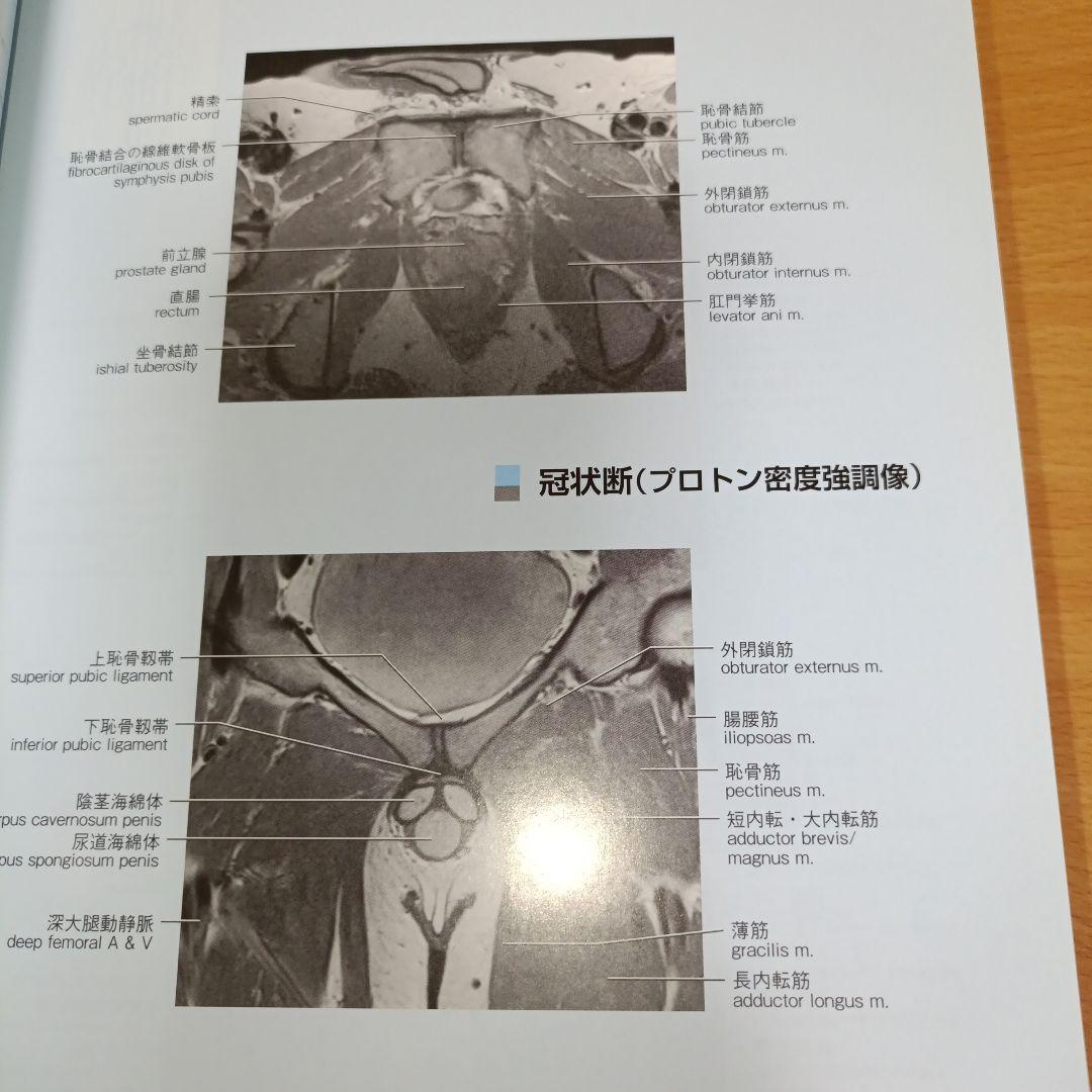 【名作運動器リハ】関節のMRI 第2版　画像理学療法作業療法リハビリ整形外科