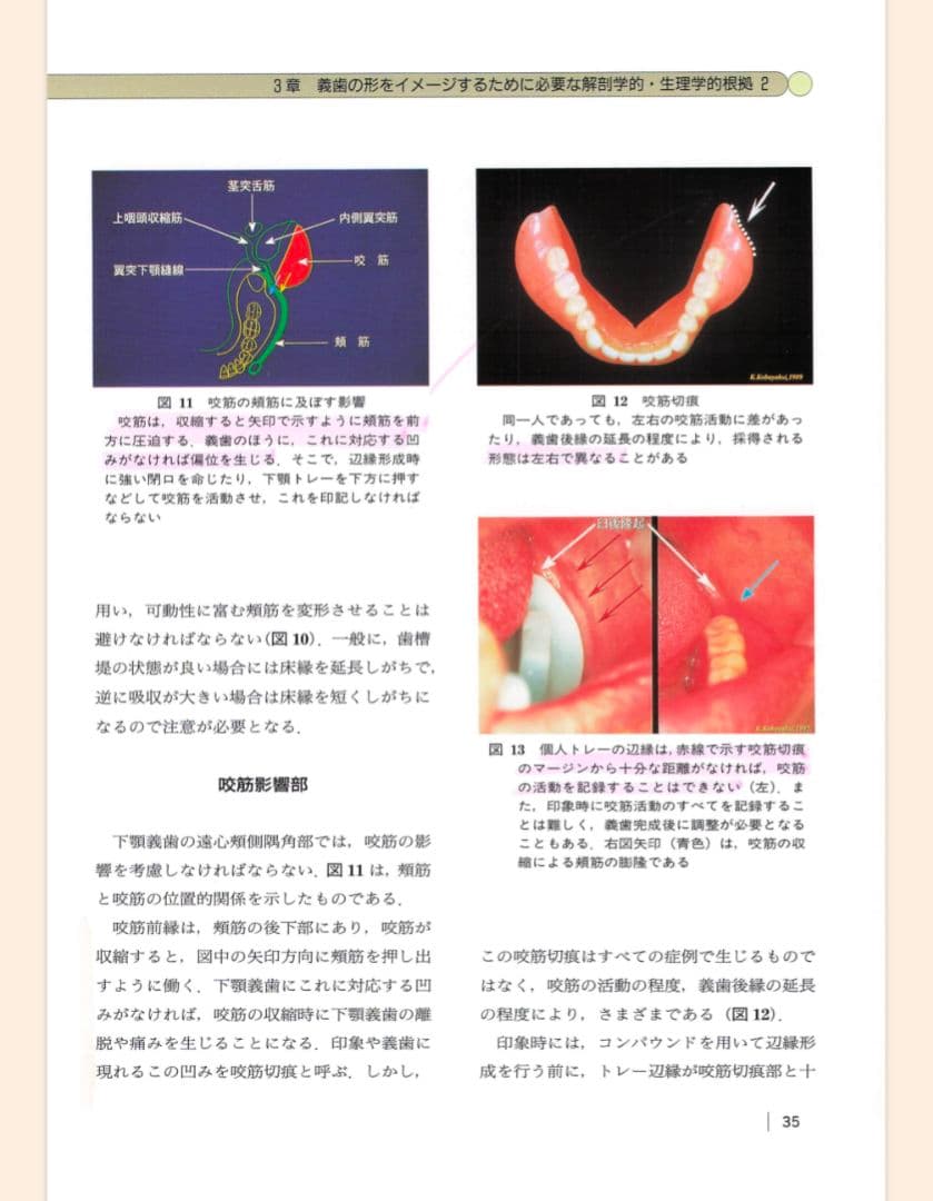 【裁断済】【即日発送】総義歯臨床の押さえどころ