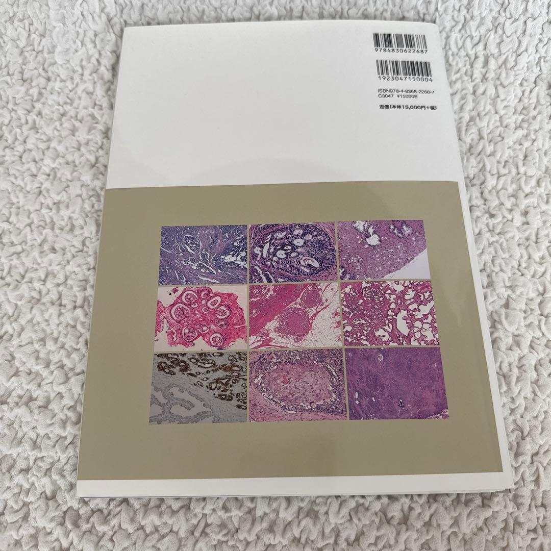 【裁断済み】前立腺癌