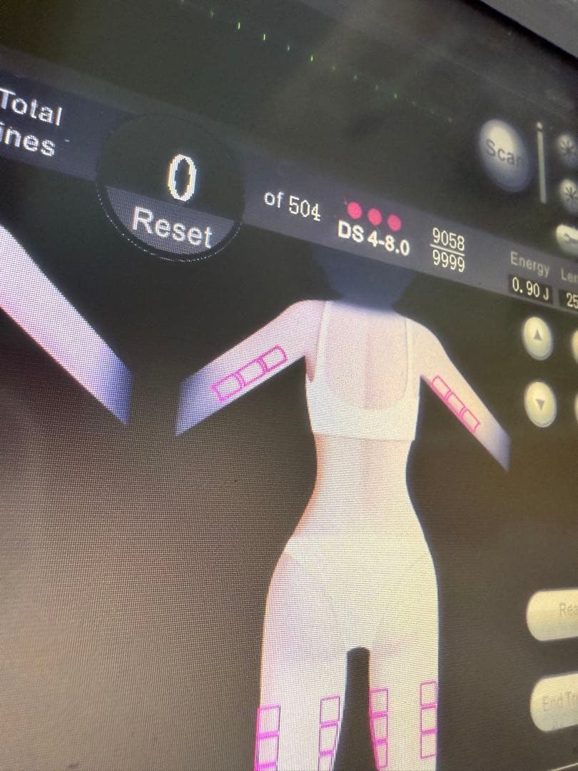 値下げ可能SMAS HIFU System 美顔器