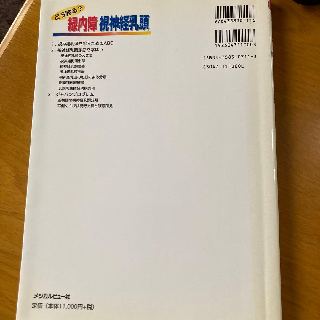 どう診る?緑内障視神経乳頭
