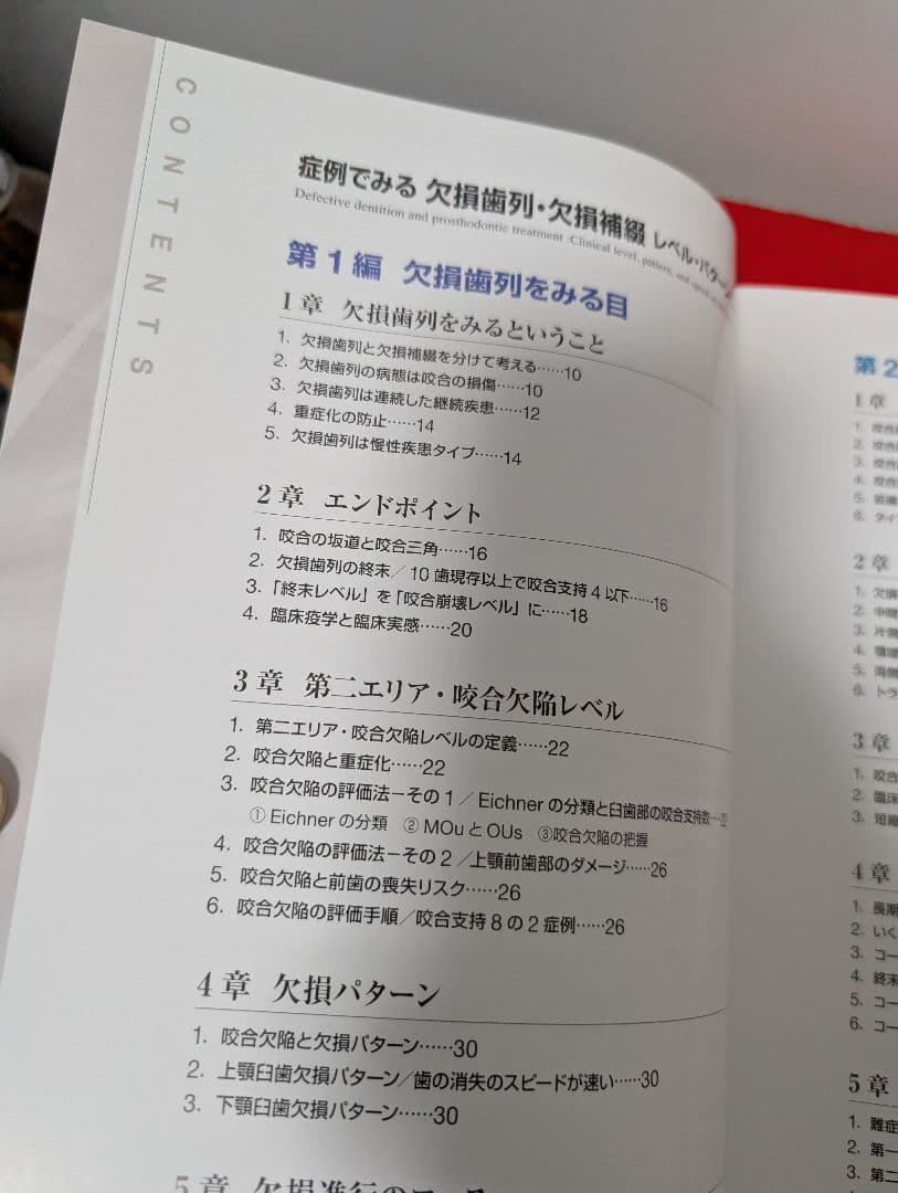 症例でみる欠損歯列・欠損補綴 レベル・パターン・スピード 宮地 建夫 本 歯科