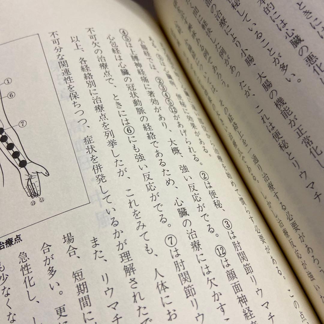 真空浄血療法　治療点解説