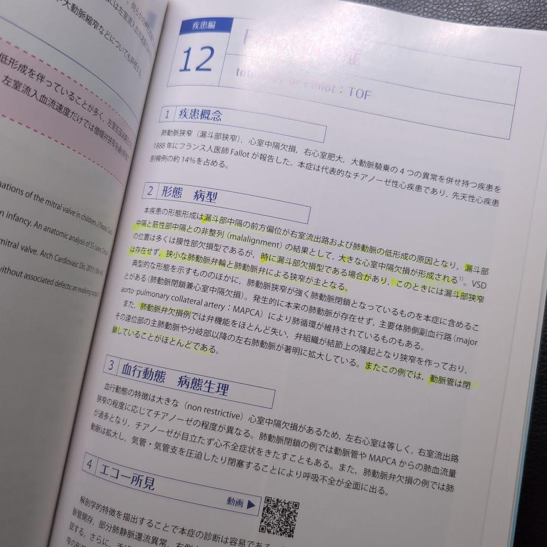 エコーで診る先天性心疾患