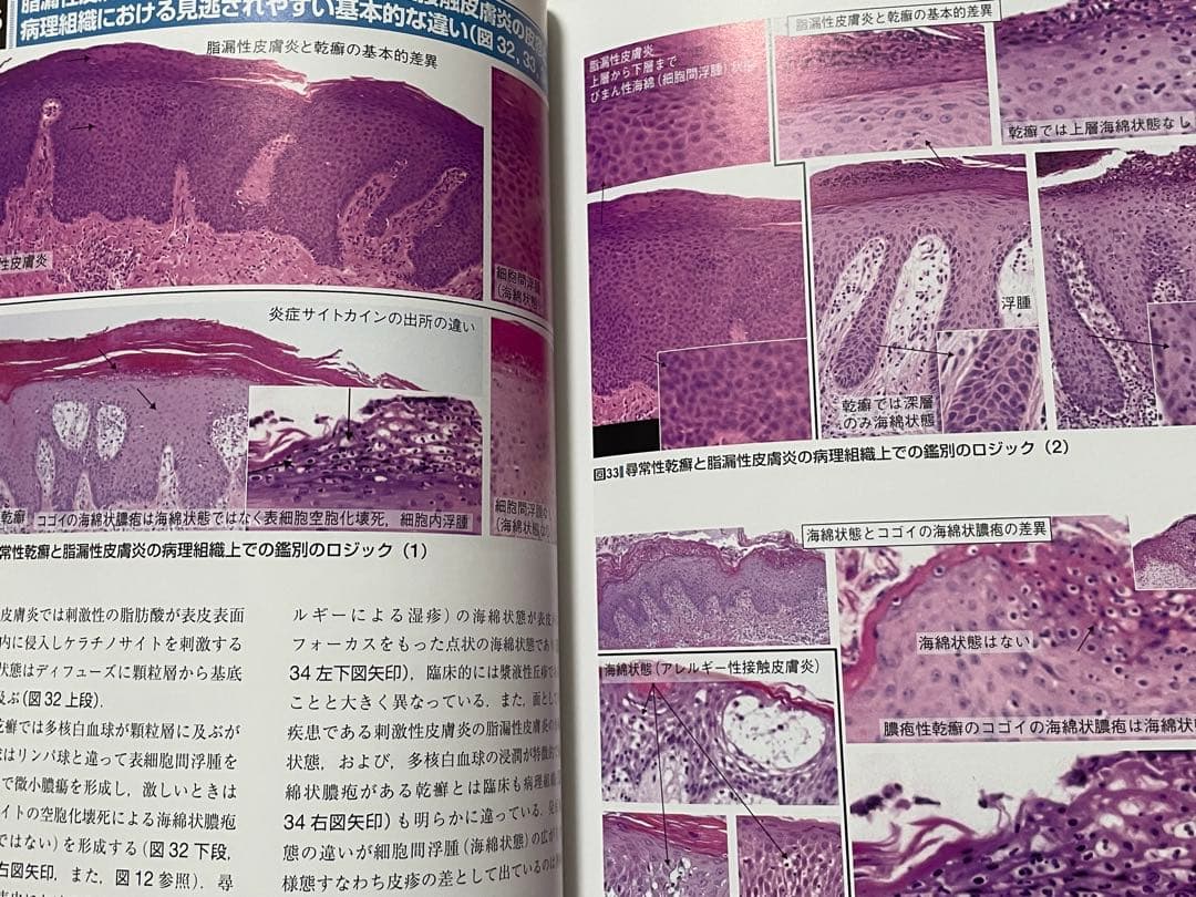 皮疹の因数分解・ロジック診断