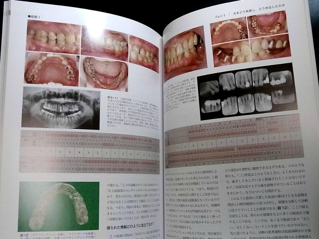 補綴臨床別冊 歯列を守る力のマネジメント 力を診る