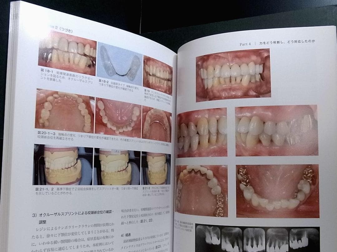 補綴臨床別冊 歯列を守る力のマネジメント 力を診る
