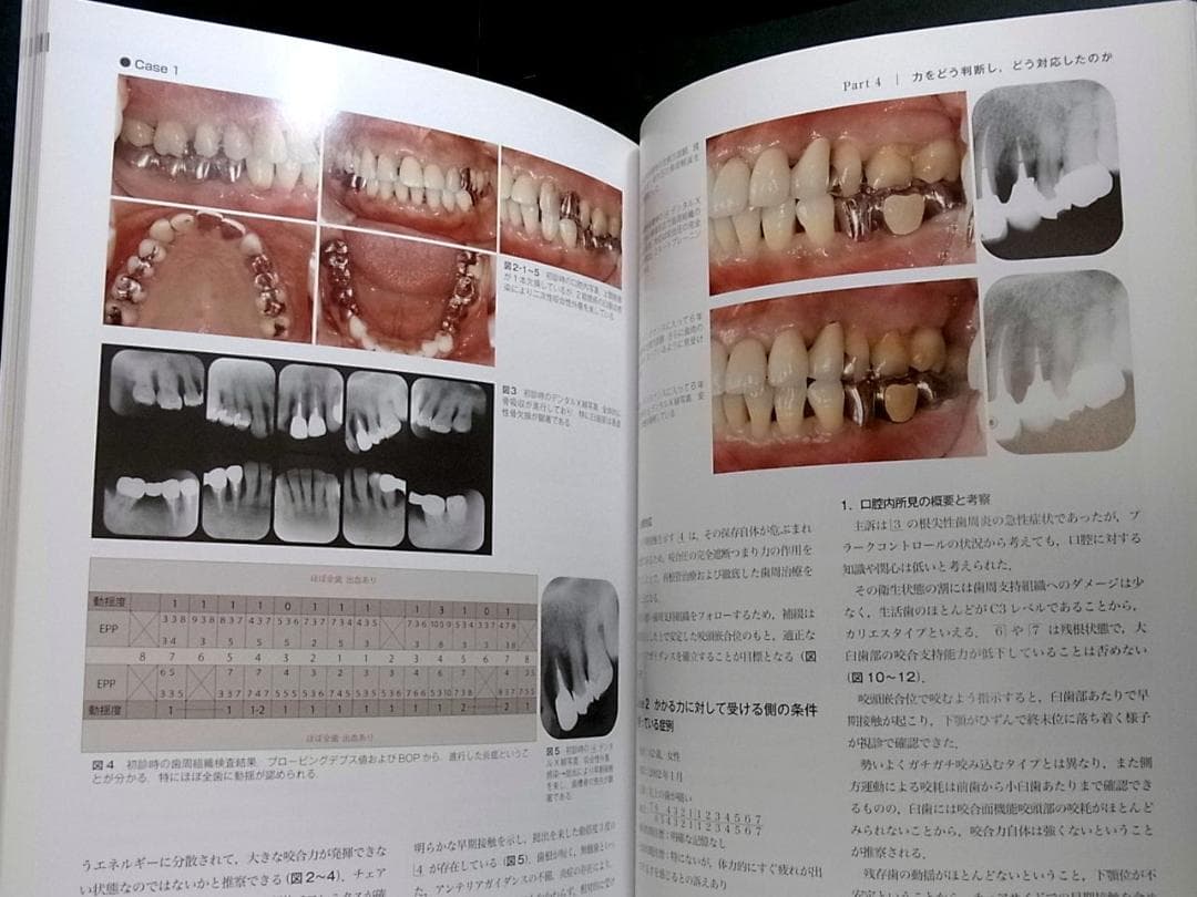 補綴臨床別冊 歯列を守る力のマネジメント 力を診る