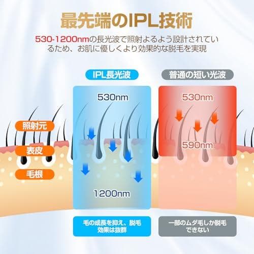 Donamo 脱毛器【サロン級IPL光脱毛器/低刺激でVIO対応】髭 M223
