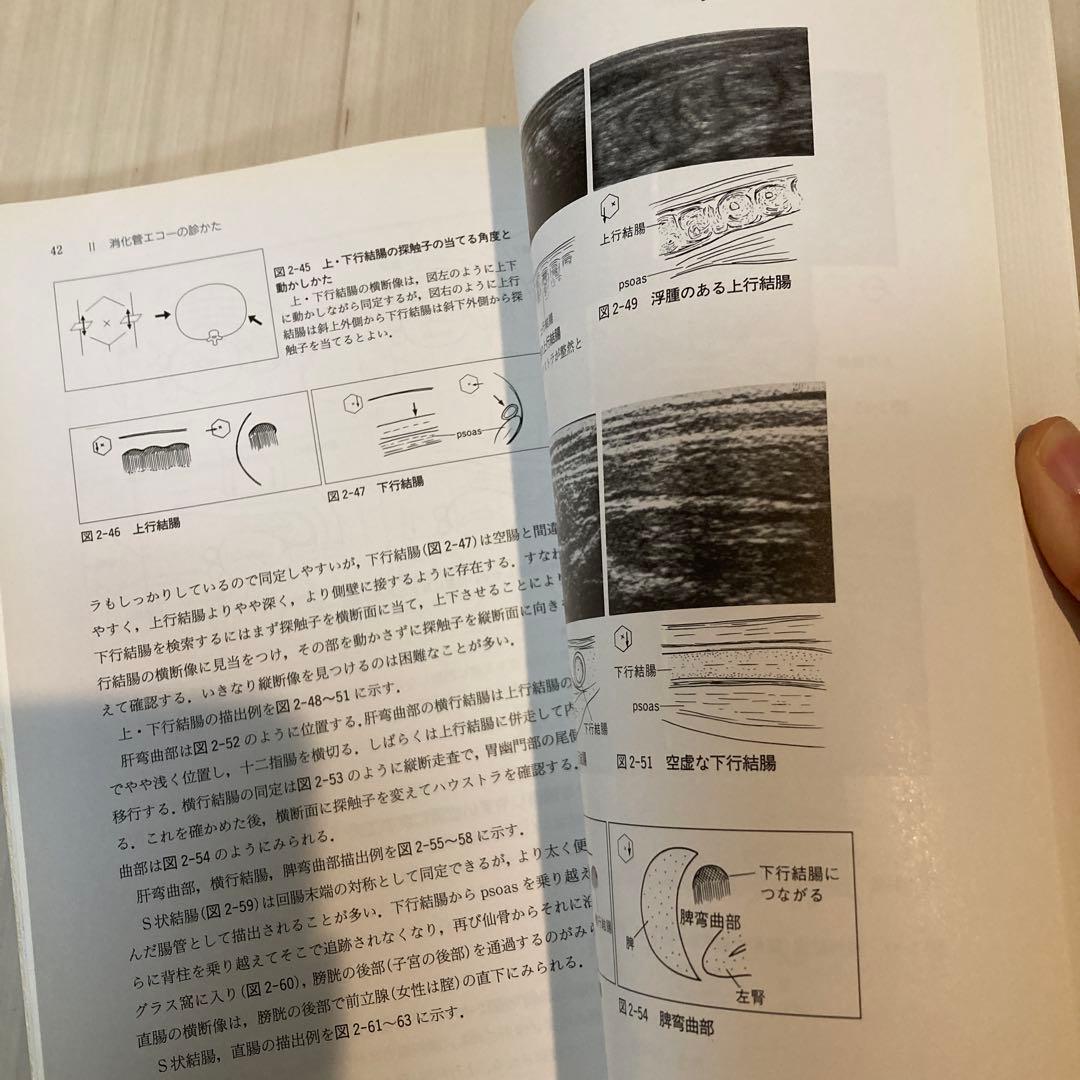 消化管エコーの診かた・考えかた　第2版