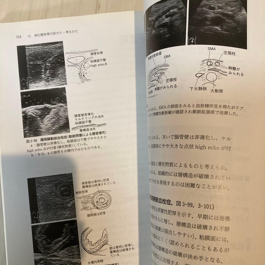 消化管エコーの診かた・考えかた　第2版