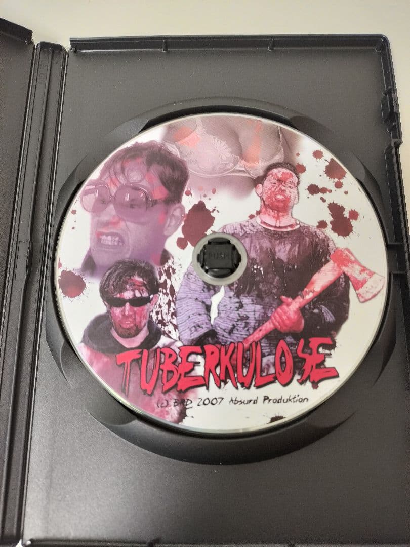 TUBERKULOSE DVD　TUBERKULOSE2 Blu-ray　輸入盤