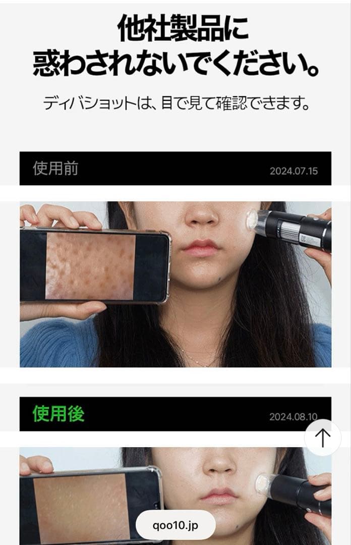 VUDE ディバショット MTSホームケア 美顔器 ニードル ハリ たるみ 毛穴