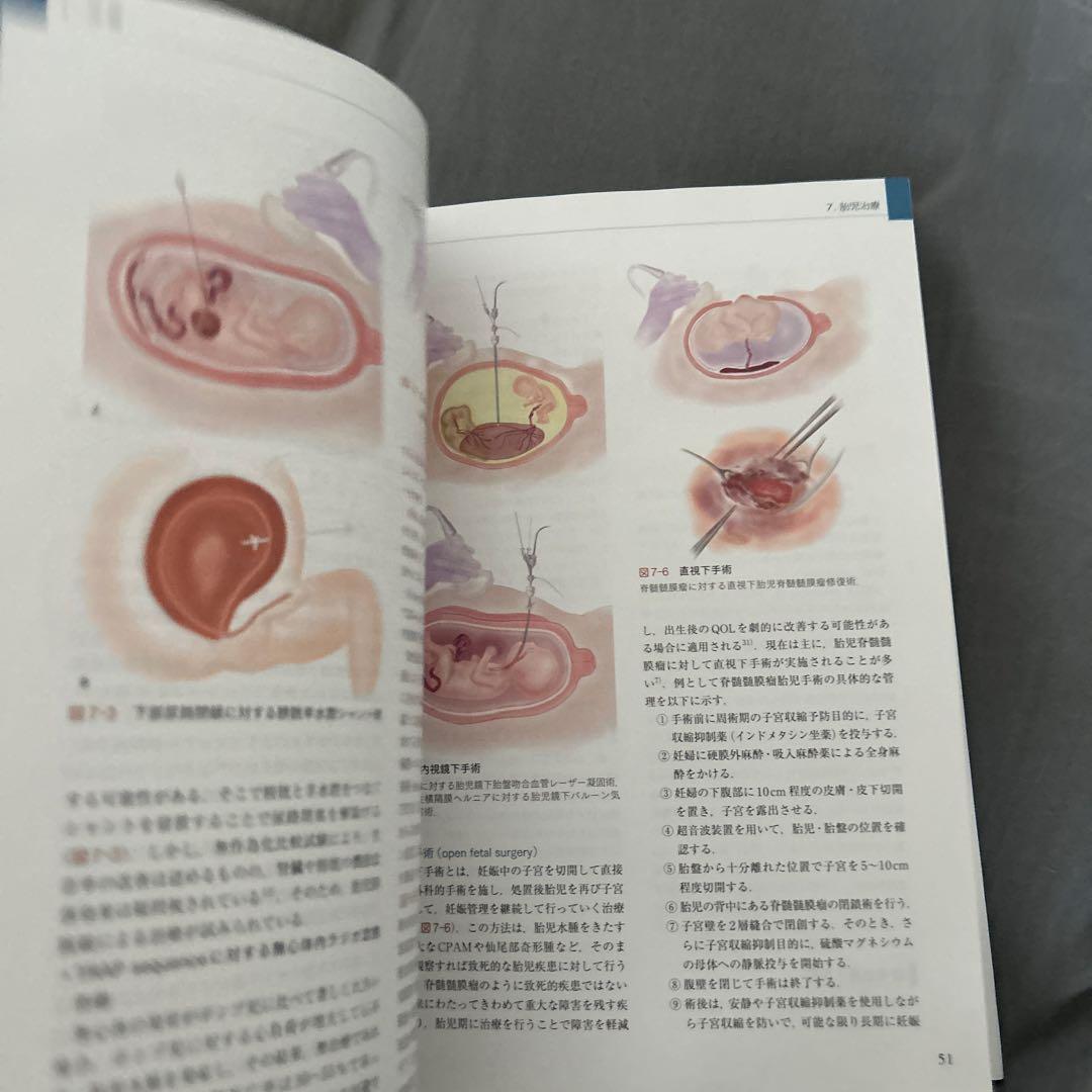 周産期マニュアル : 胎児疾患の診断から管理まで （交渉の書籍）