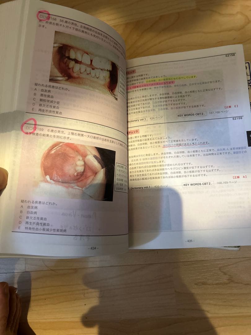 CBT辞典、２冊