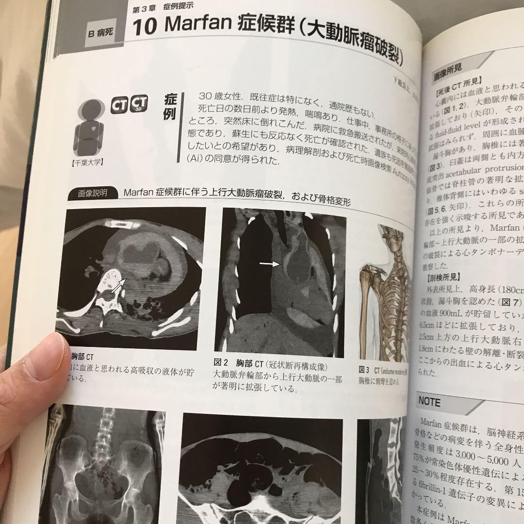 オートプシー・イメージング読影ガイド