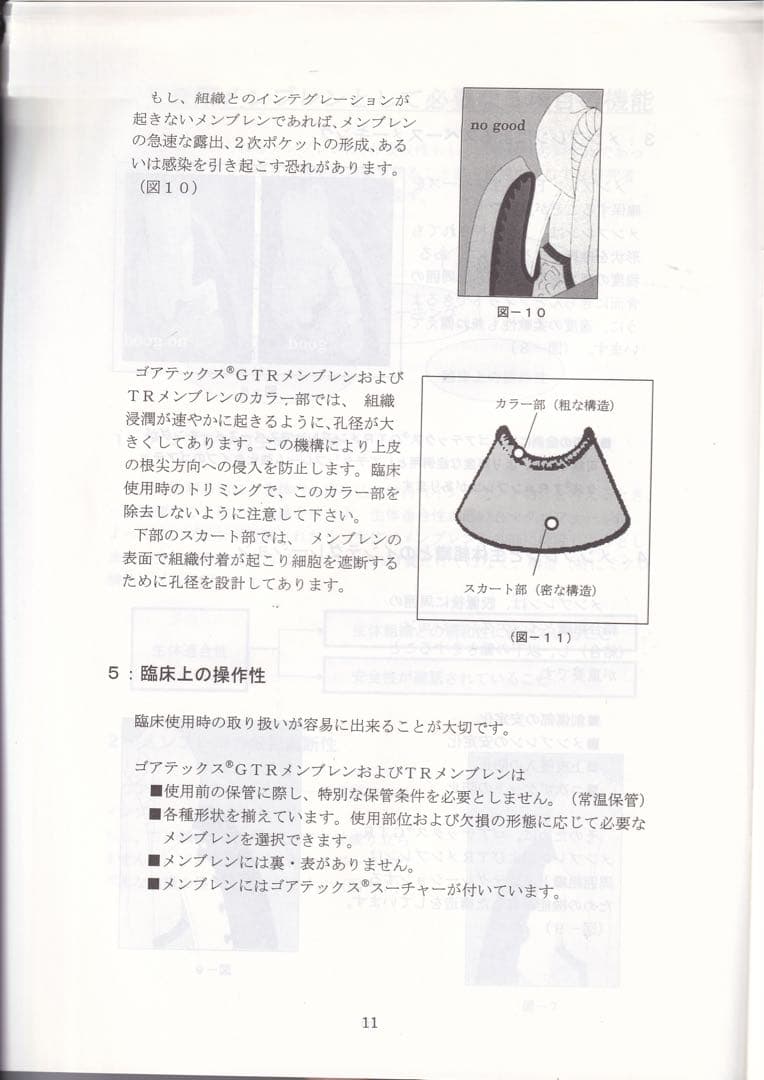 ゴアテックス　メンブレン　レジメ #歯科　　#インプラント　#GBR