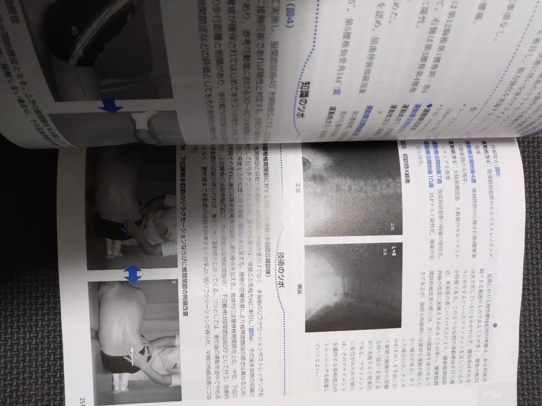 整形外科運動療法ナビゲーション　関節機能解剖学に基づく 下肢体幹　理学療法　PT