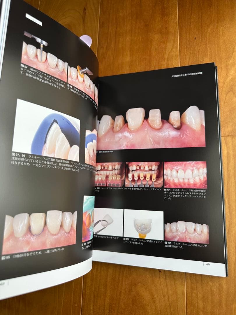 The Tooth Preparation 支台歯形成 岩田淳 歯科 補綴