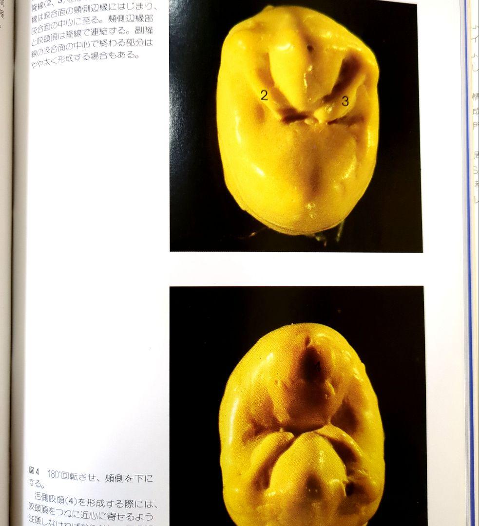 アナトミカル日歯咬合面形成法