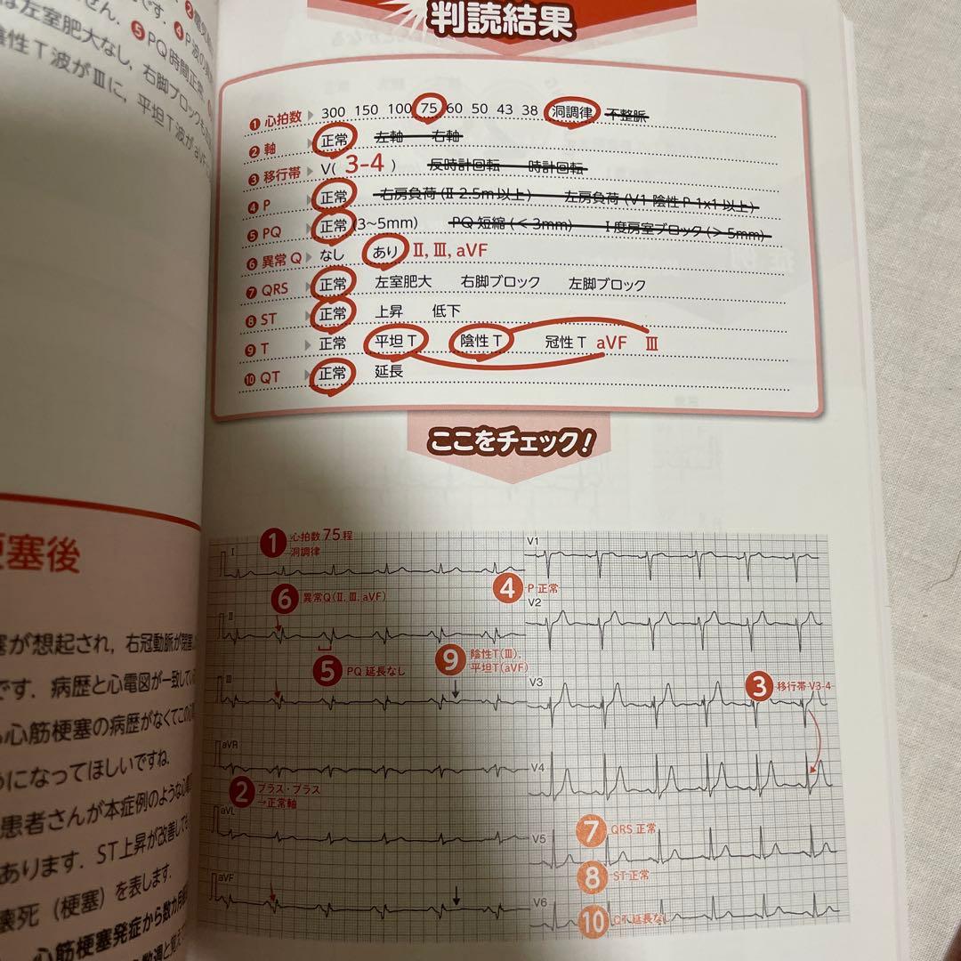 【看護師・看護学生むけ】心電図関連書籍5冊セット