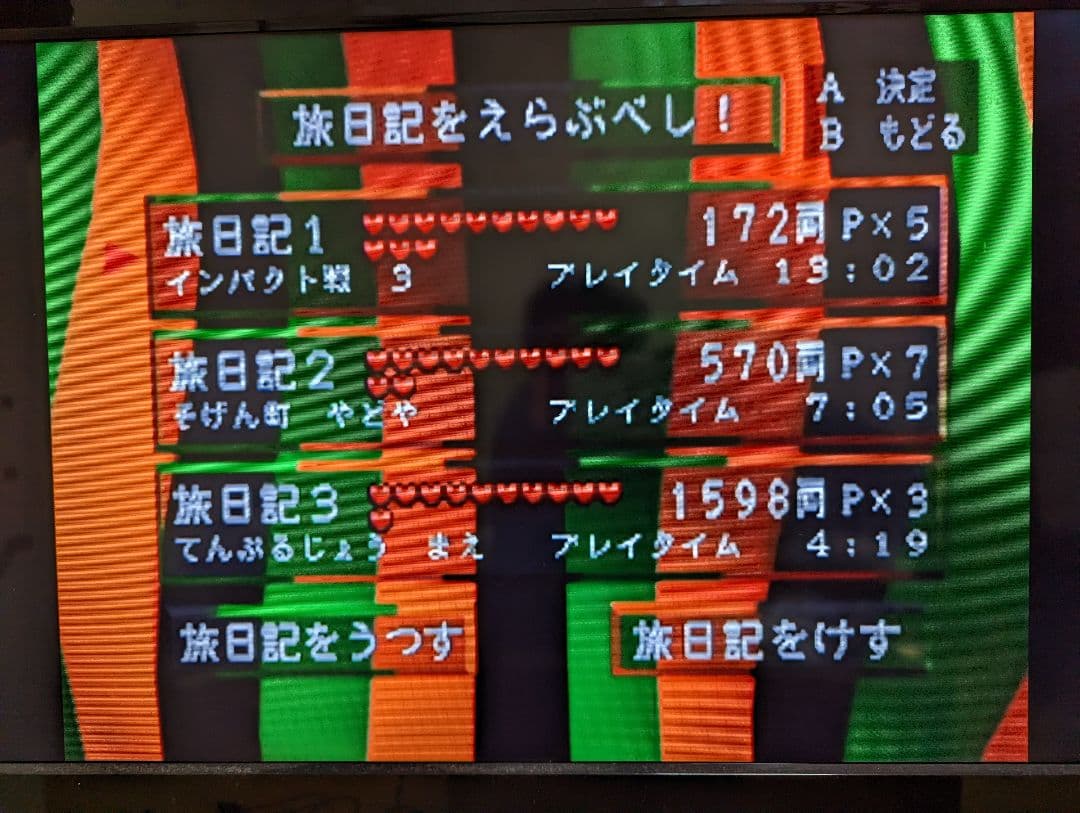 ニンテンドー64本体×ソフト7個×メモリーパック×振動パック