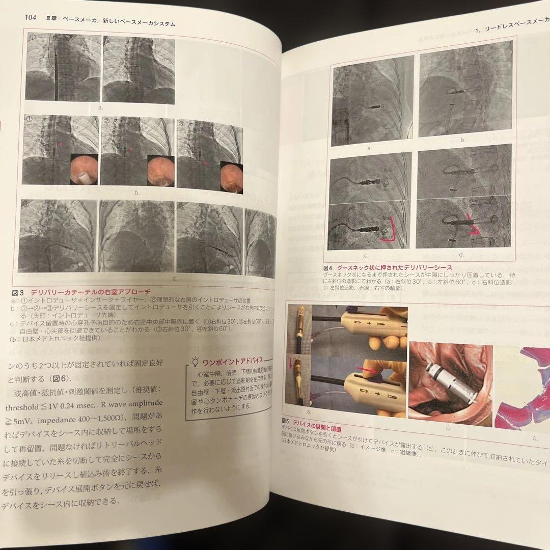 不整脈デバイス治療バイブル