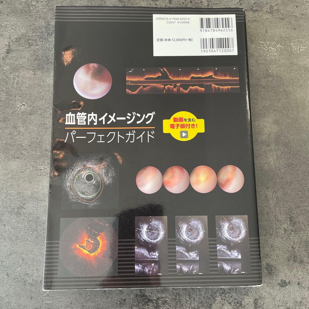 血管内イメージング パーフェクトガイド