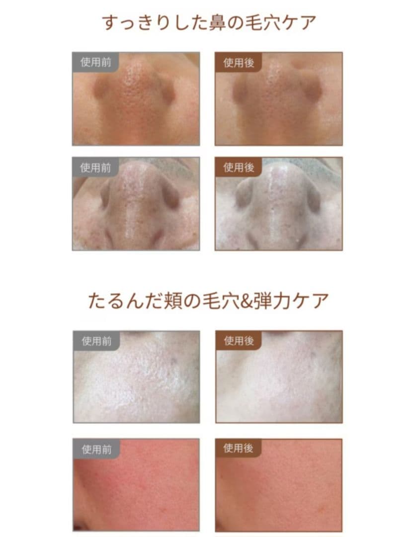 pamsibc TERRA VITA 2箱