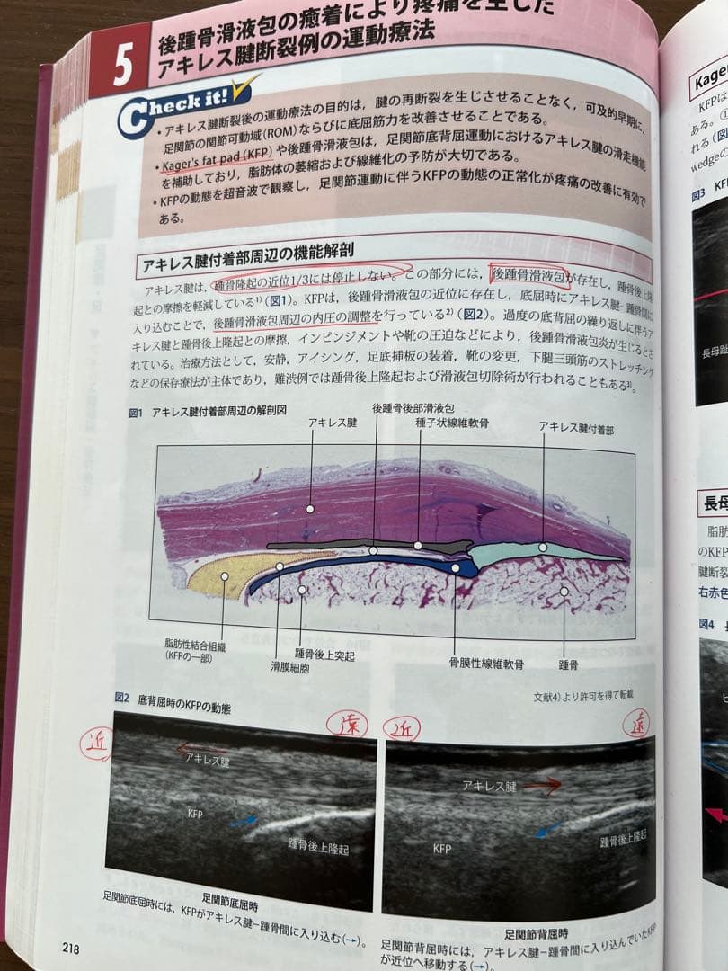関節機能解剖学に基づく整形外科運動療法ナビゲーション上肢・体幹、下肢 2冊セット