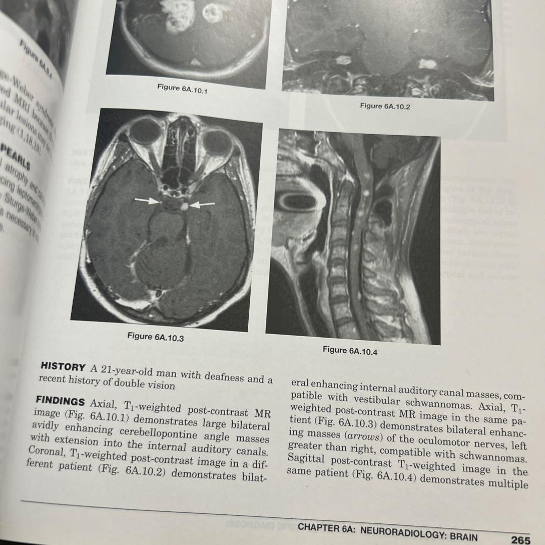 Aunt Minnie’s Atlas Imaging Diagnosis
