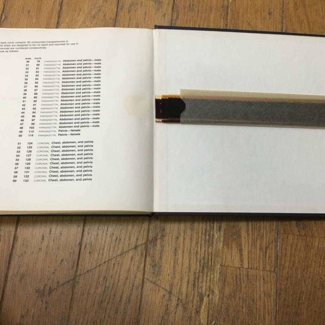 A color atlas of sectional anatomy医学洋書大型