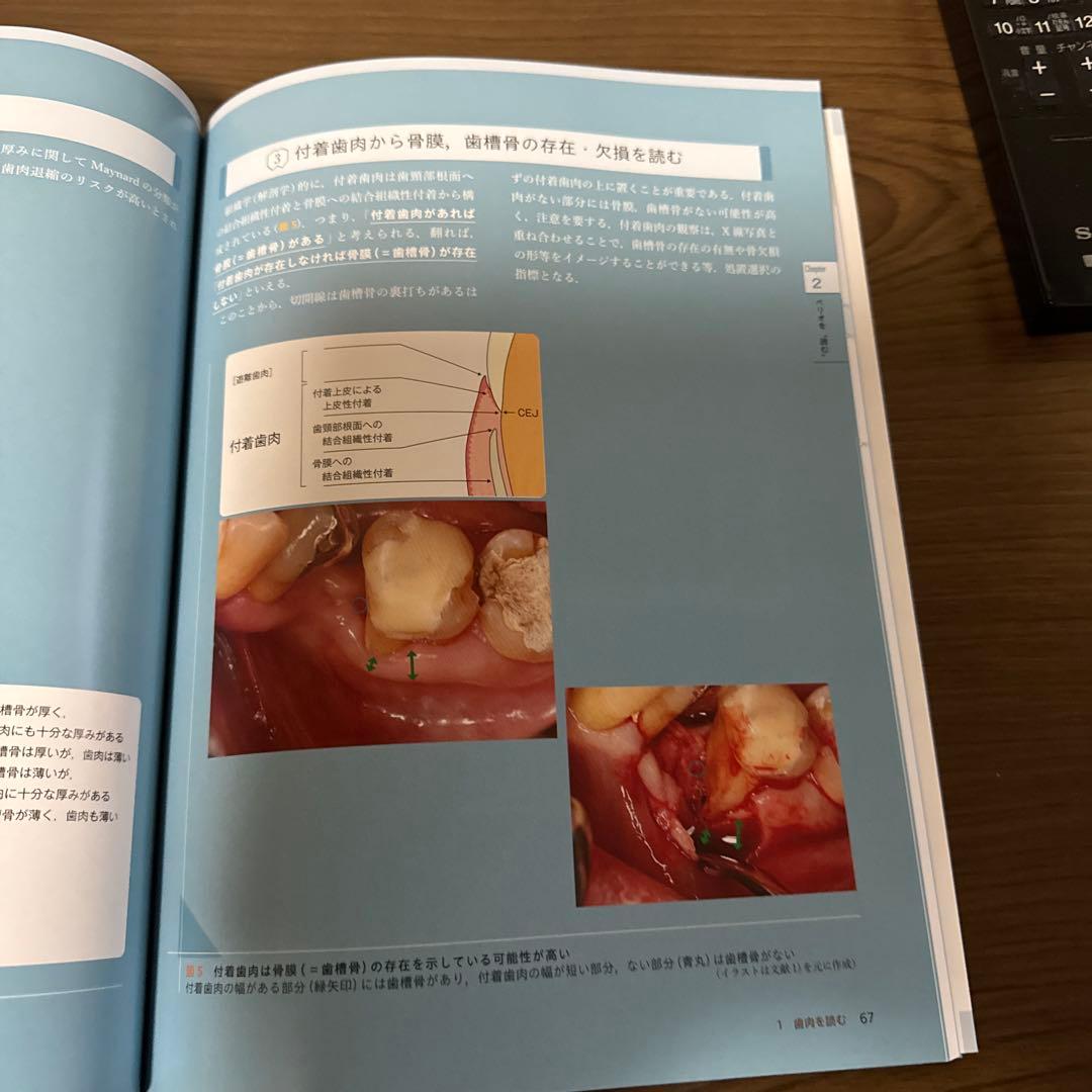 ペリオの治療形態と治し方