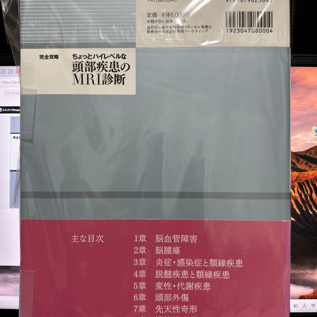 ちょっとハイレベルな頭部疾患のMRI診断