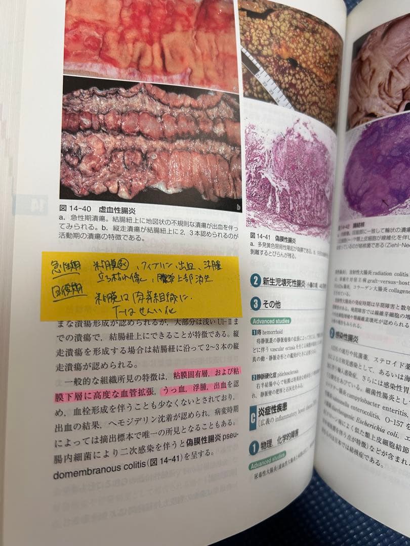 標準病理学 第4版 医学書院