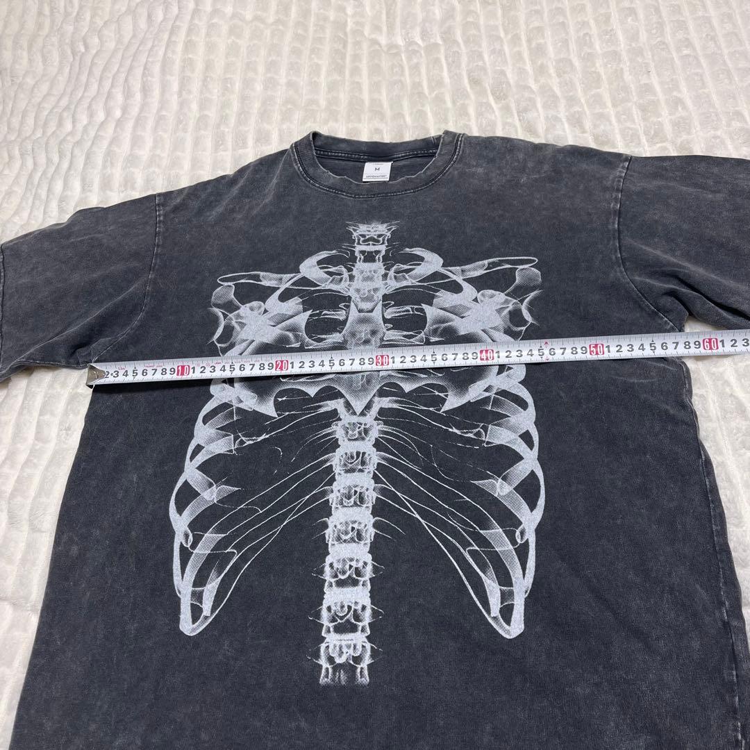 ARTIEMASTER ダメージ加工 レントゲン スケルトン プリント Tシャツ
