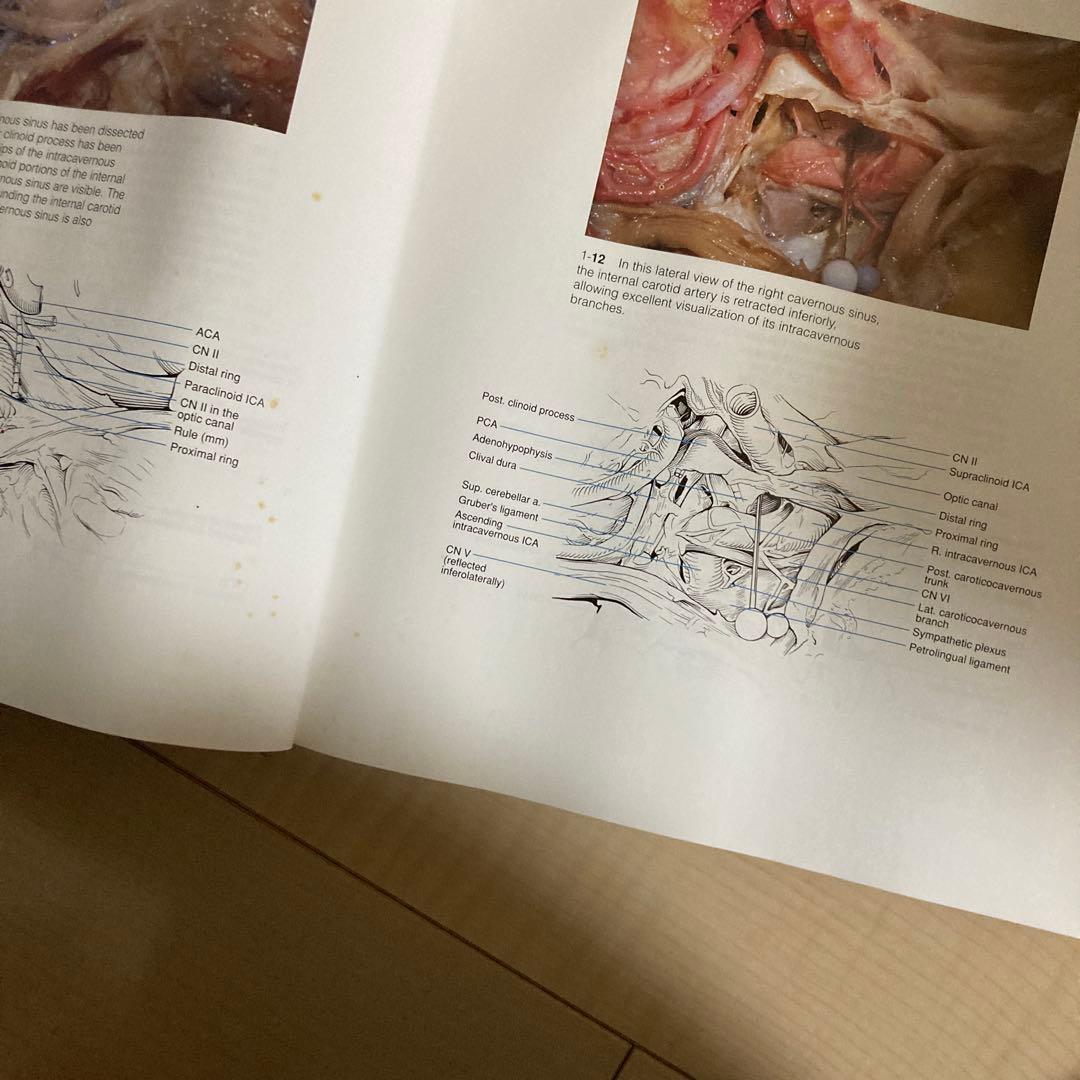 健康・医学 Color Atlas of Microneurosurgery