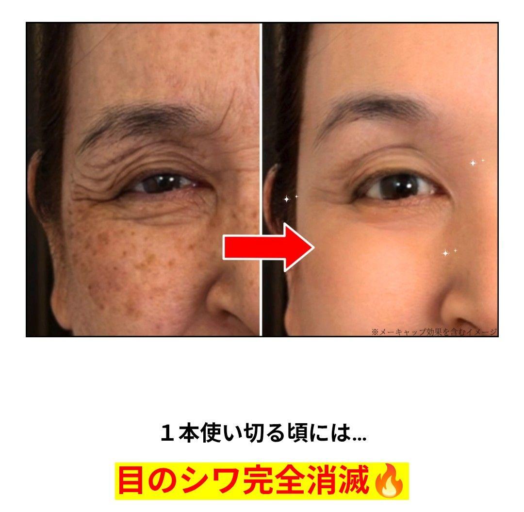 Lumie're ヴァレシア クリーム 薬用クリームＭRH　11/1受取分
