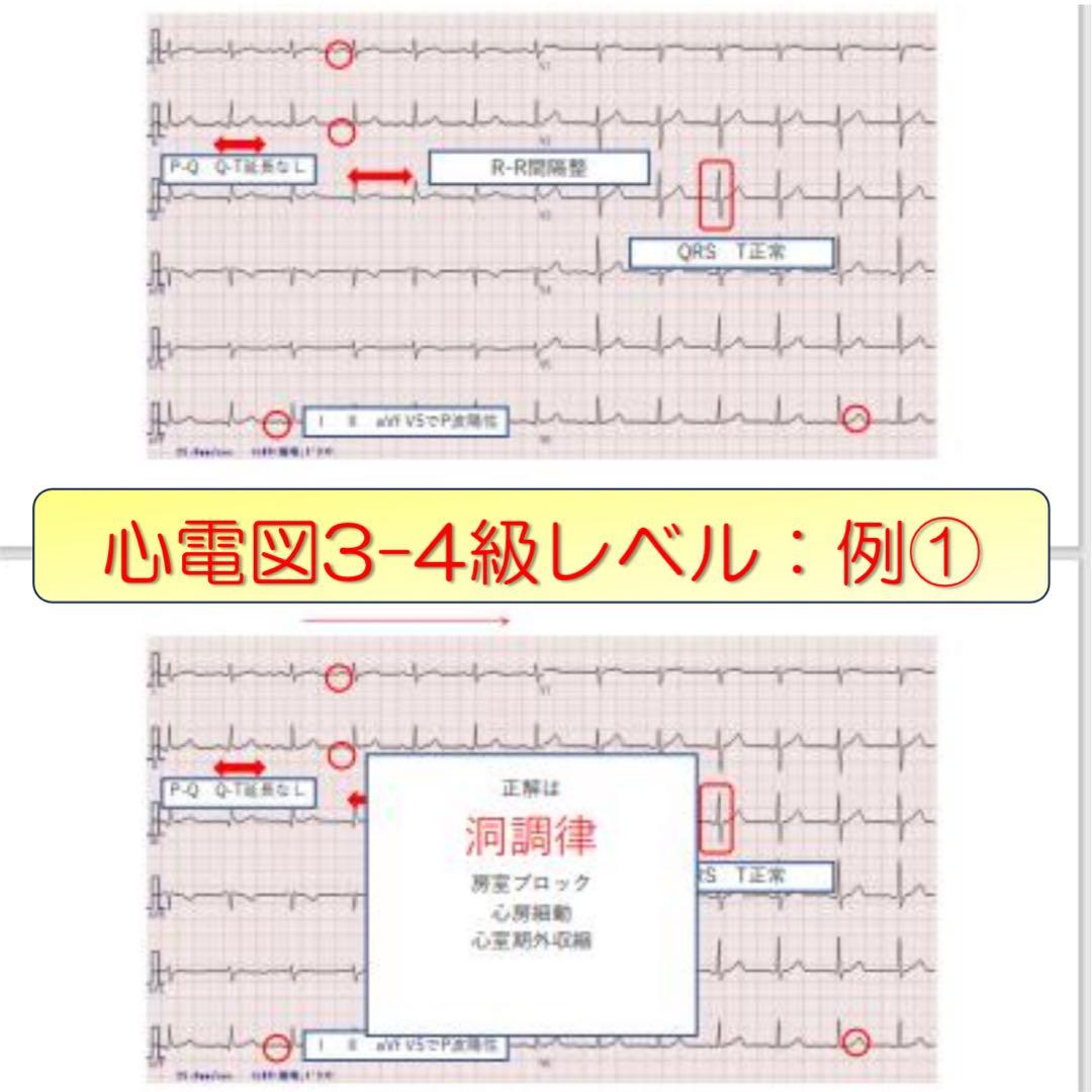 心電図検定対策7点セット