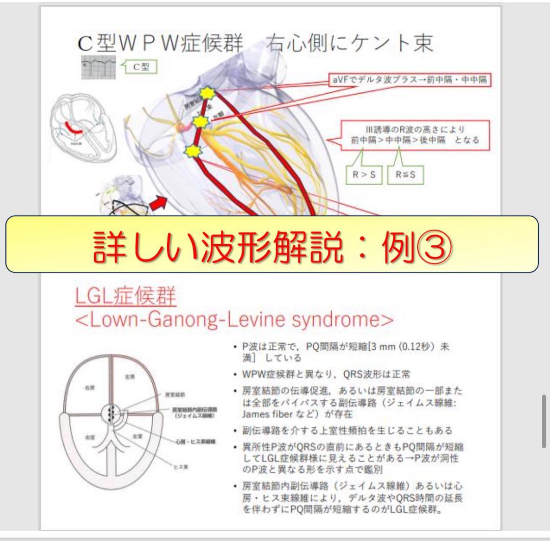 心電図検定対策7点セット