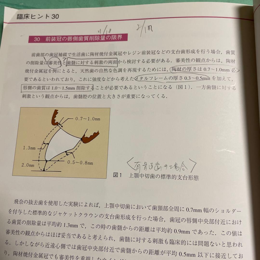 ❤️❤️❤️❤️補綴の診断と予後❤️❤️❤️❤️役に立つ臨床ヒントと反省