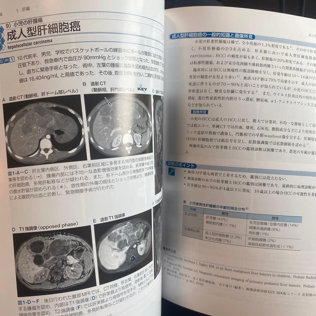肝胆膵の画像診断 改訂第2版