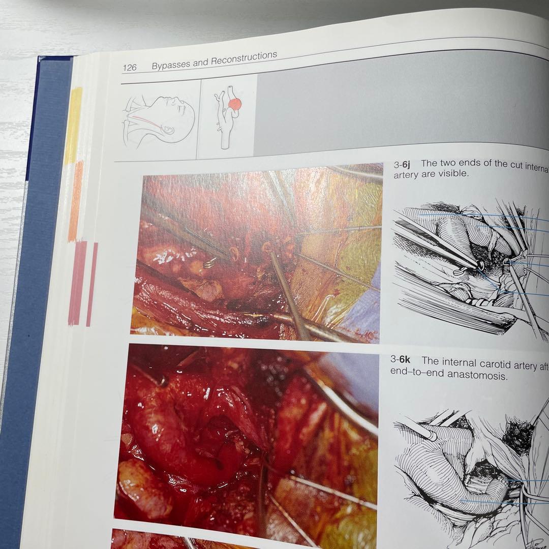 健康・医学 Color atlas of microneurosurgery