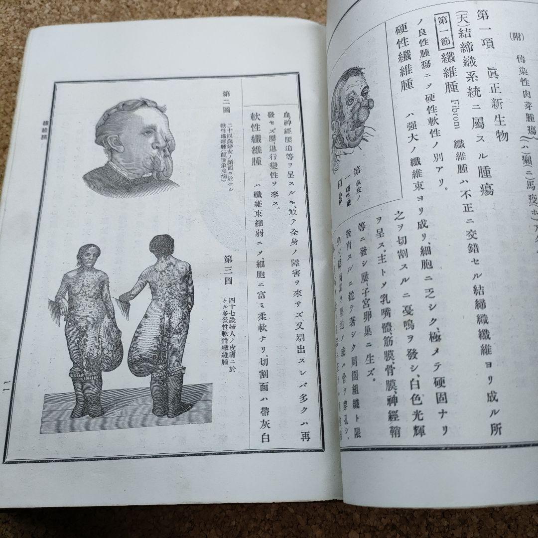 改訂外科類症鑑別 明治34年 三版 大石栄三 朝香屋書店 明治医学書 古書資料