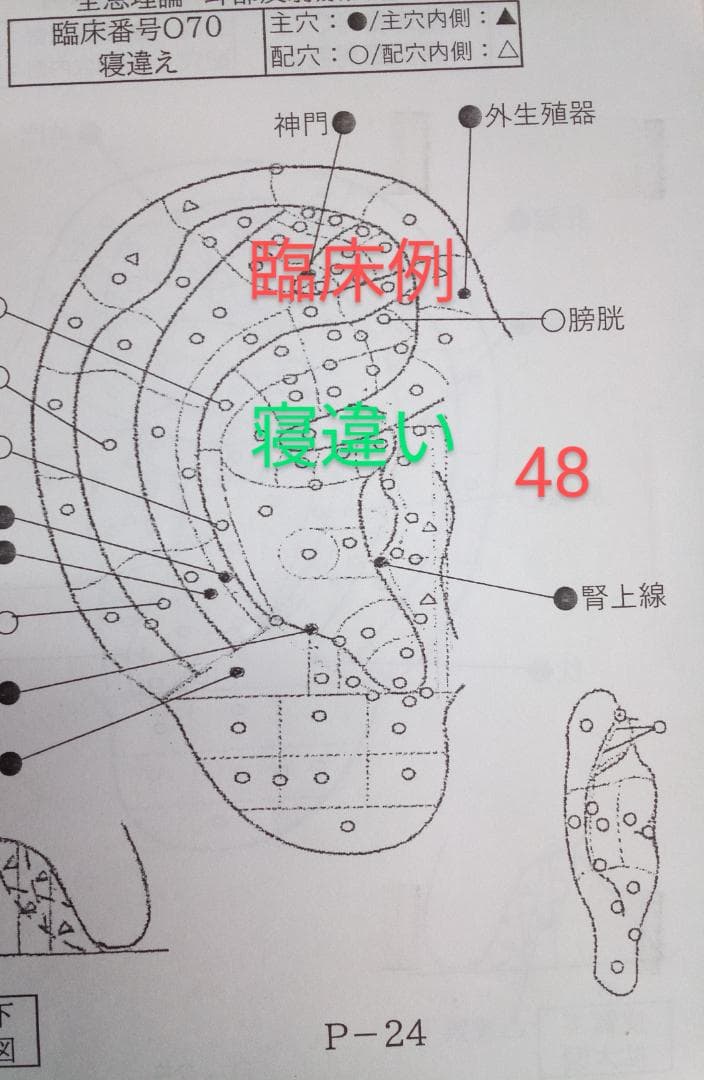 Bc:耳つぼ学ぶ：耳臨床54例集+臓器/躯体ラミネート+解説冊子/プリントset