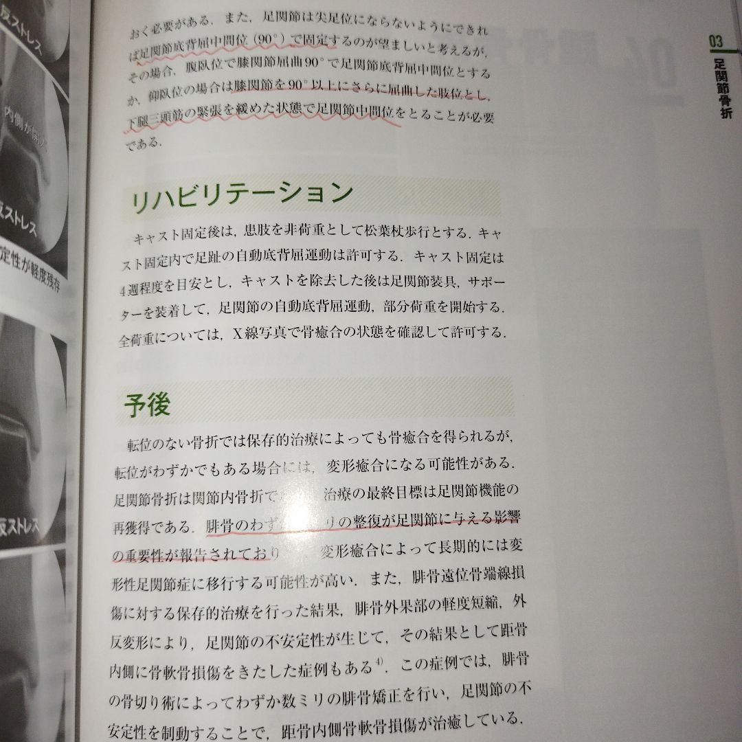 Y0986 骨折の保存的治療 日常診療の疑問に答える 保存的治療