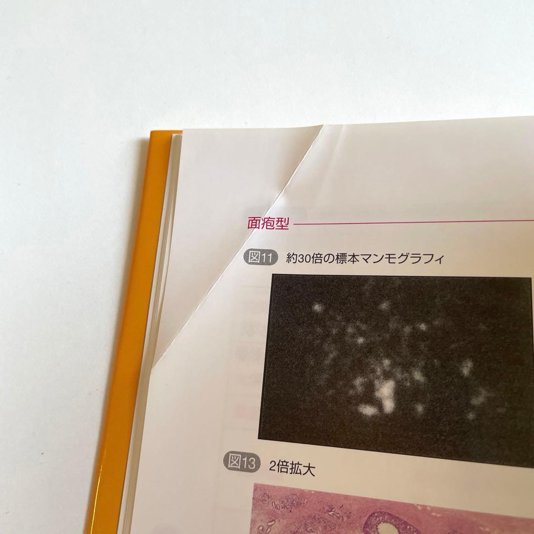 手にとるようにわかるマンモグラフィ 2